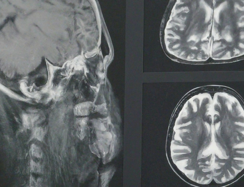 Tusindvis af patienter med stroke har svært ved at bruge det digitale sundhedssystem